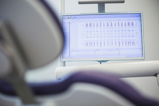 Comprehensive Guide to Full Mouth Dental Implant Prices in the United States: What You Need to Know