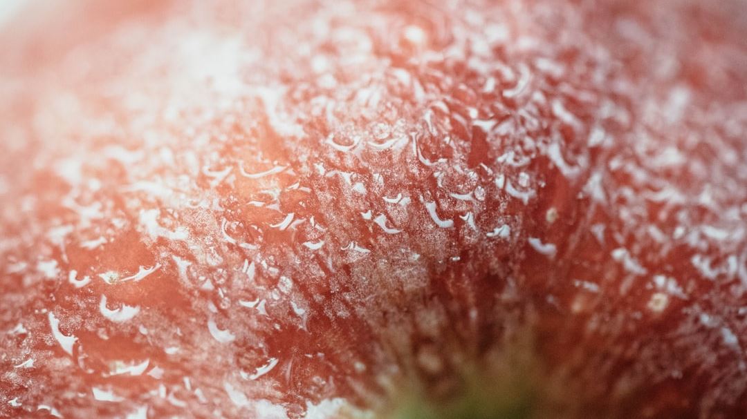 Achieving Clearer Skin from Plaque Psoriasis in Just 4 Months: A Transformative Journey