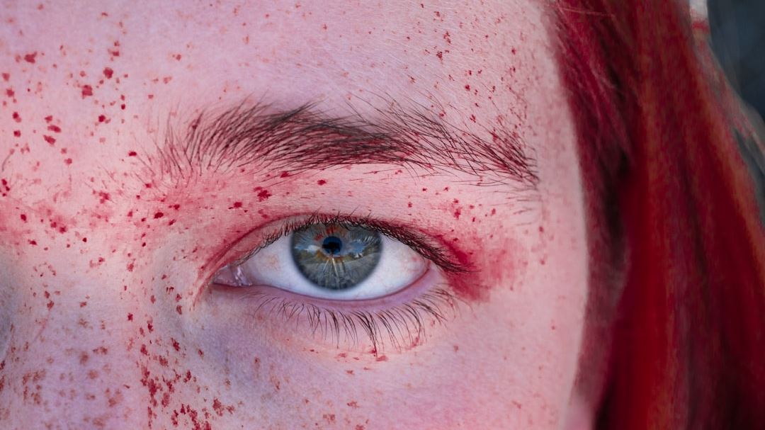How to Identify Your Rash Pictures: A Comprehensive Guide for Accurate Diagnosis