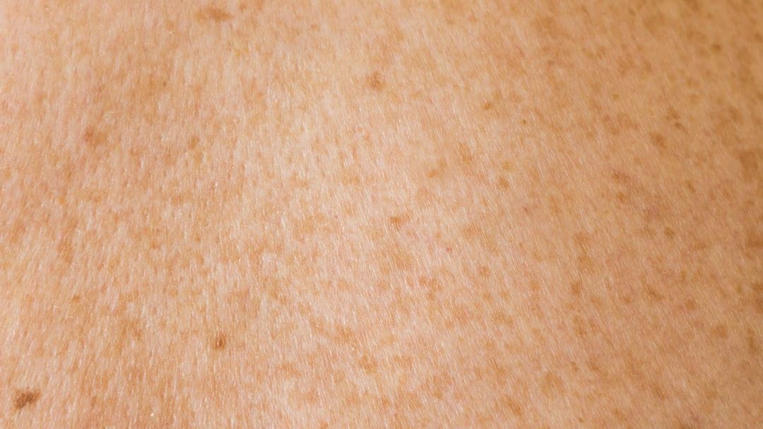Comprehensive Guide to Identifying Skin Rashes Pictures: What Every U.S. Reader Should Know