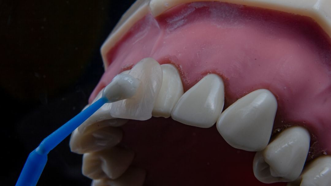 Renew Dental Implants: Expert Guidance for Rejuvenating Your Smile