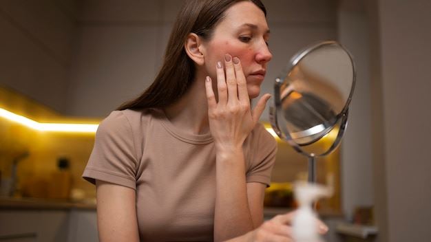 Understanding Lupus: A Comprehensive Guide to Managing this Chronic Autoimmune Disease in the United States