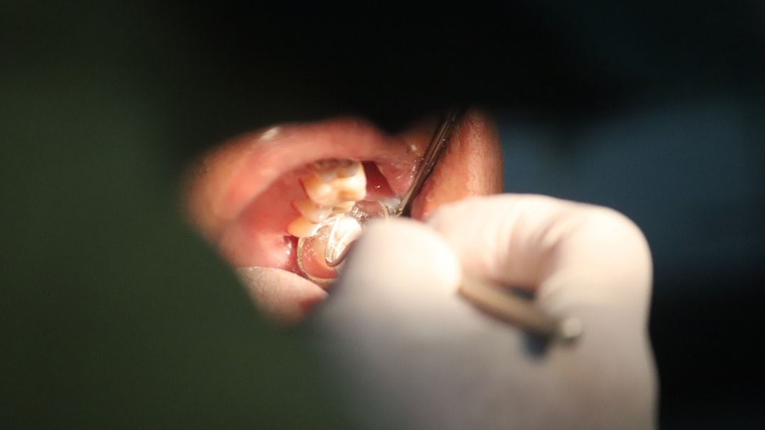 Understanding Implant Costs in the United States: A Comprehensive Guide