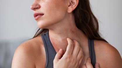 Understanding Itchy Skin Rashes: Causes, Symptoms, and Effective Treatments