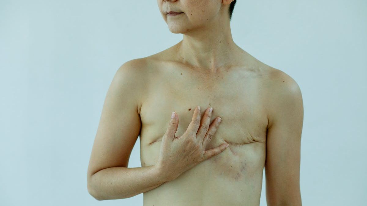 Understanding the Different Types of Skin Cancer: A Comprehensive Guide