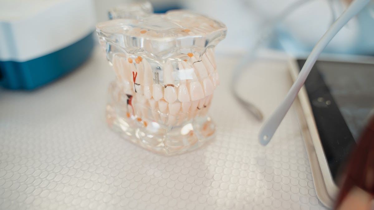 Affordable Solutions for Dental Restoration: Your Guide to Low Cost Dental Implants in the United States