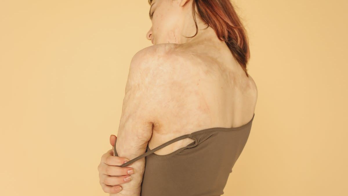 Understanding Dermatitis Through Images: A Comprehensive Guide for Patients and Healthcare Providers