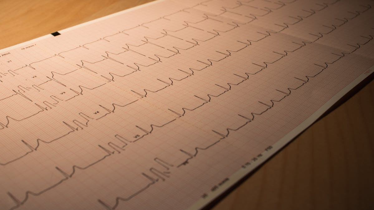 Understanding Aortic Stenosis and Atrial Fibrillation: A Comprehensive Guide for Patients and Caregivers