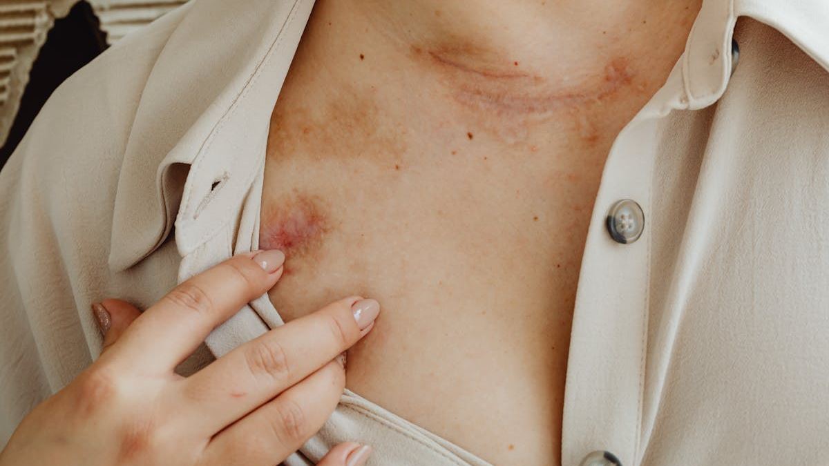 Comprehensive Guide to Catastrophic Injury Lawsuits: How a Specialized Catastrophic Injury Lawyer Can Make a Difference