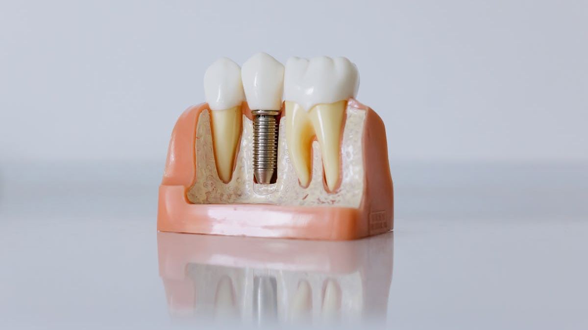 Your Comprehensive Guide to Finding Dentist Implants Near Me in the United States