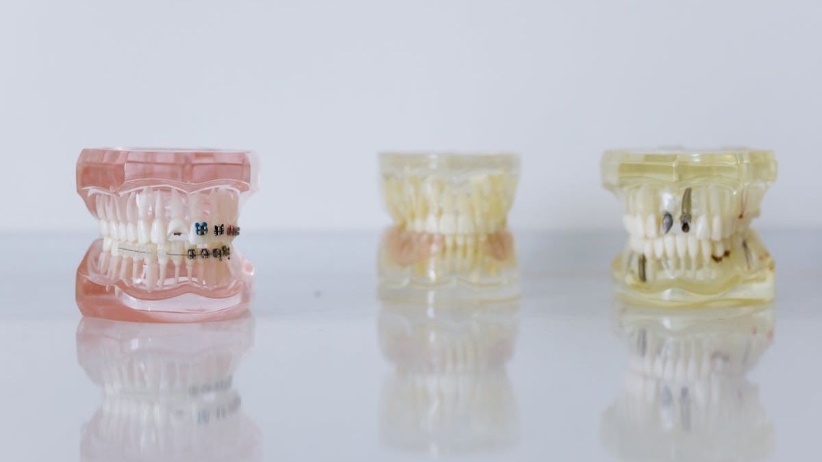 The Complete Guide to Dental Implants: Restoring Smiles and Confidence