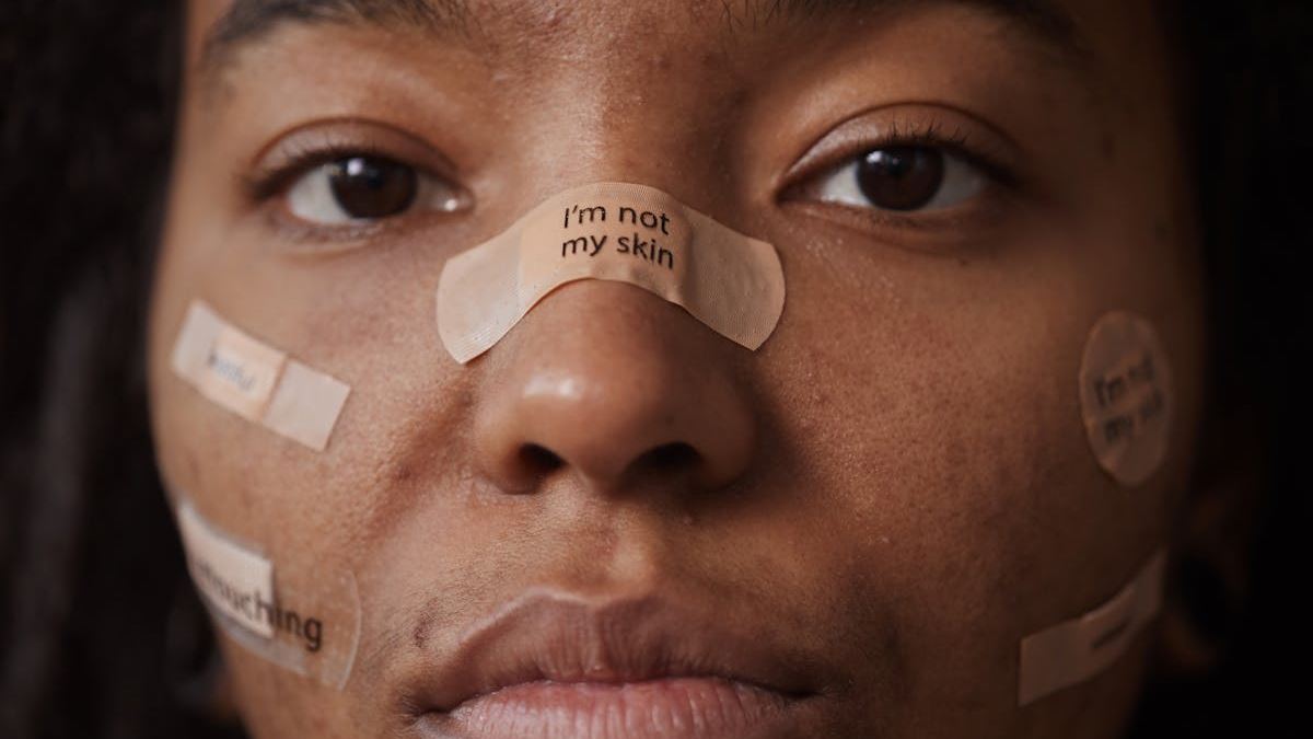 Understanding Common Skin Conditions: A Comprehensive Guide for Americans