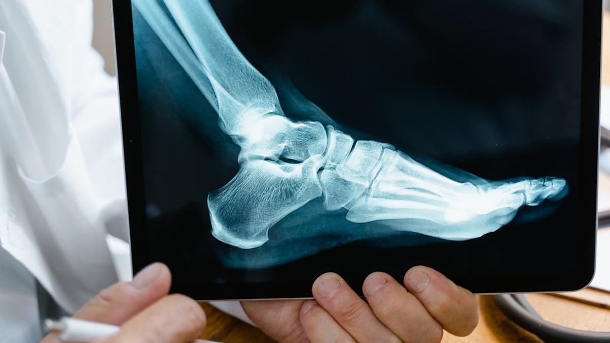 Comprehensive Guide to Choosing a Spinal Cord Injury Attorney in the United States