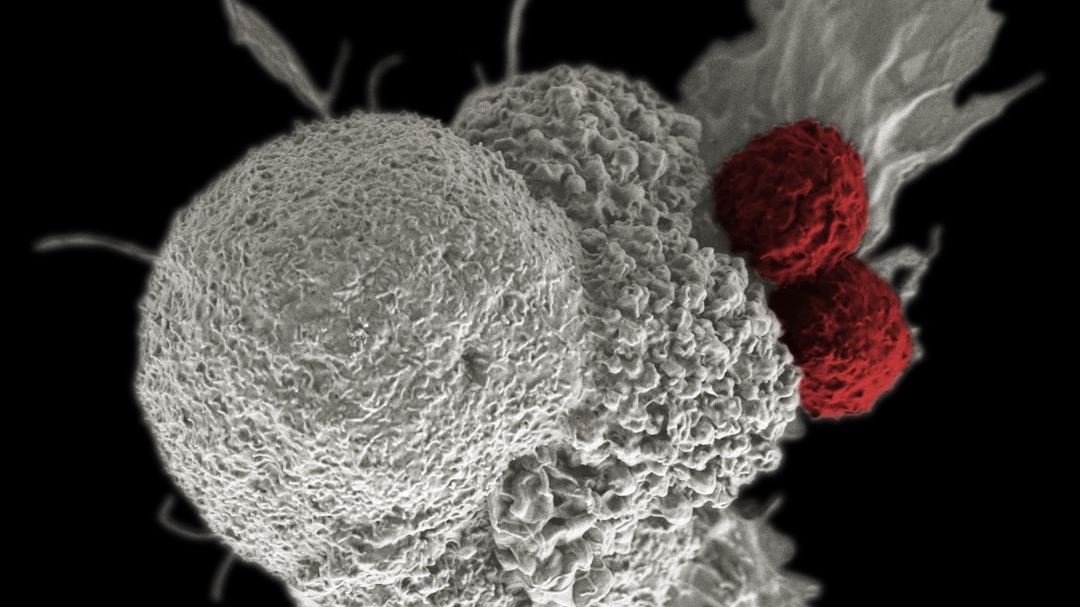 Understanding NSCLC Chemotherapy: A Comprehensive Guide for Patients and Caregivers