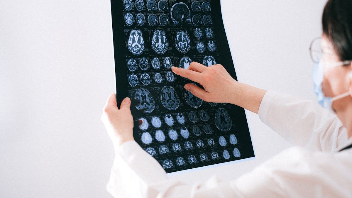 Finding the Best Brain Injury Attorney Near Me: A Comprehensive Guide for Victims in the United States