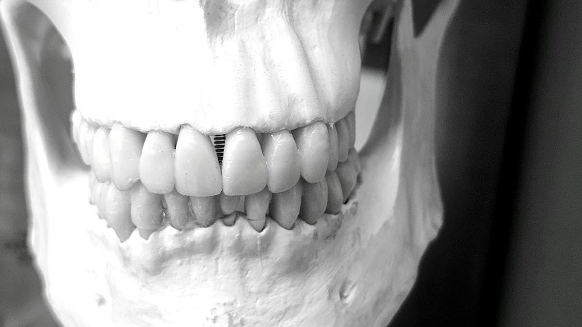 The Comprehensive Guide to Choosing the Right Implant Dentist in the United States