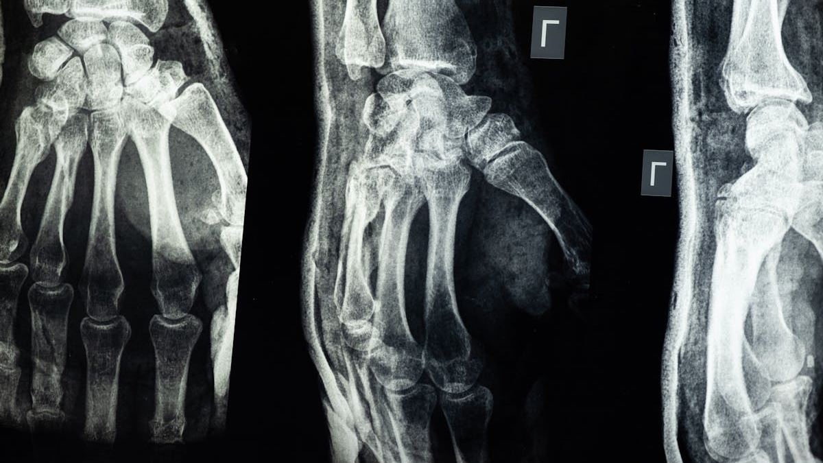 Understanding the Role of a Car Injury Attorney in Your Compensation Claim