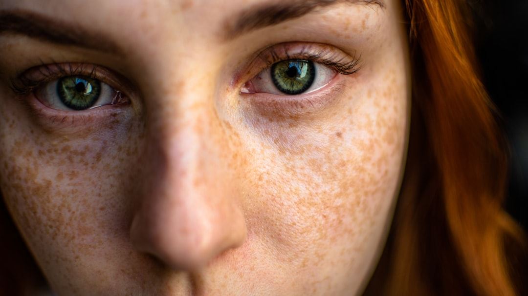 Comprehensive Guide to Skin Rash Identify Chart: How to Recognize and Understand Common Rashes in the US