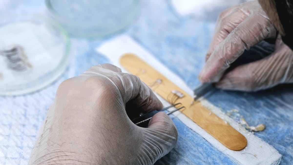Discovering the Best Clinic Hair Transplant in the United States: A Comprehensive Guide