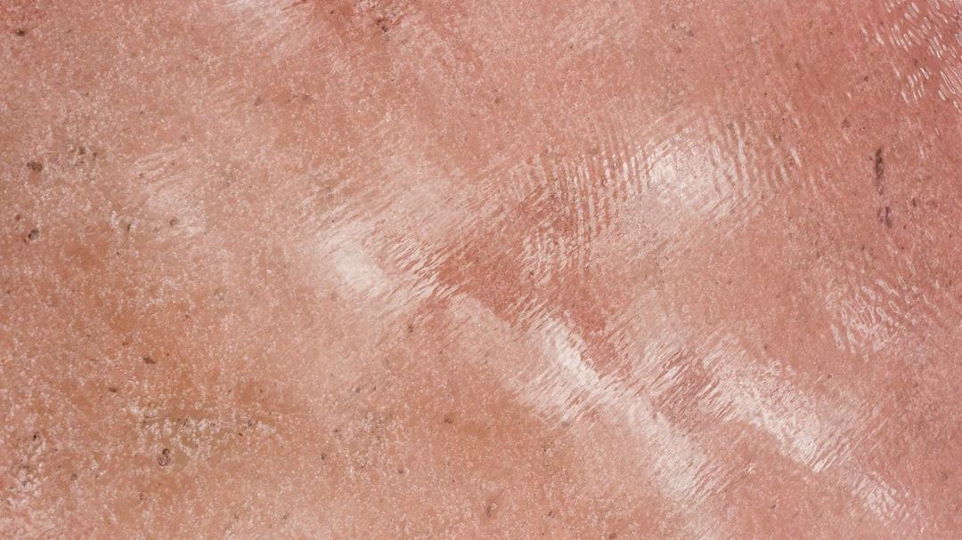 Understanding What Contact Dermatitis Looks Like: A Comprehensive Guide