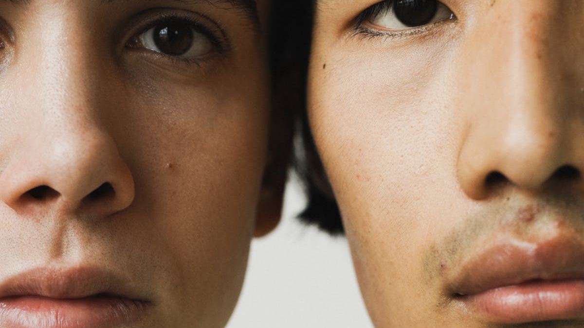 Understanding Photos All Skin Rashes: Causes, Types, and When to Seek Medical Attention