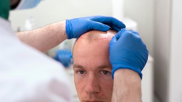 Comprehensive Guide to Hair Loss Solutions: Restoring Confidence and Hair Health