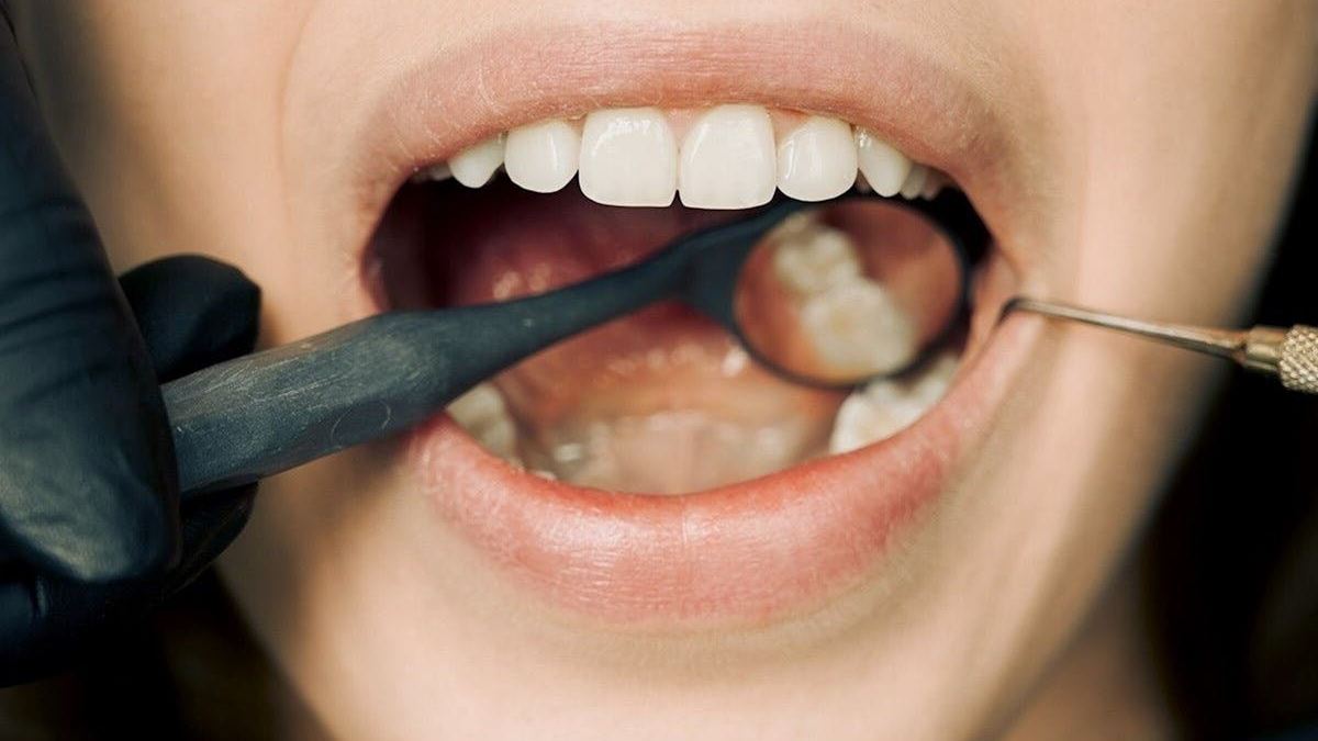 Do I Buy Dental Insurance? A Comprehensive Guide to Making the Right Choice