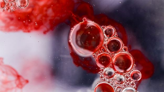 Comprehensive Guide to Thrombotic Thrombocytopenic Purpura Treatment in the United States