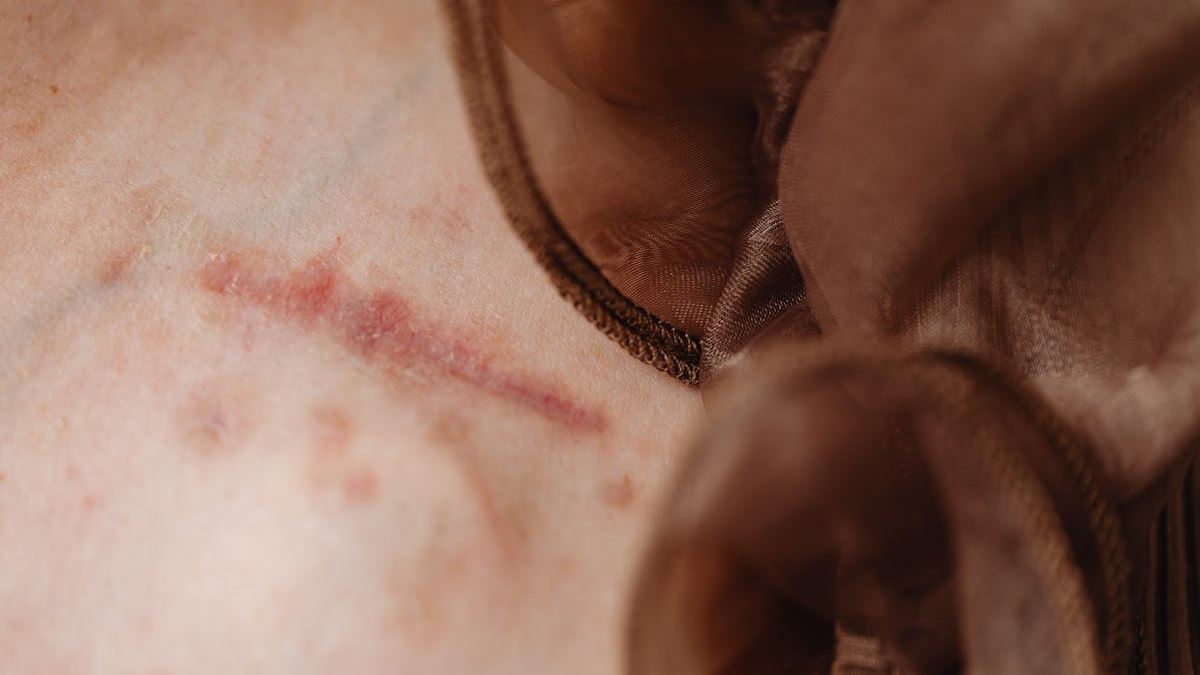Top 10 Essential Tips to Find the Right Injury Lawyer for Your Personal Accident Case