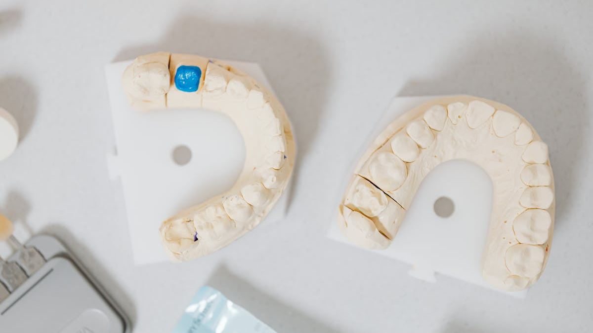 Finding the Best Dental Implant Near Me: Your Comprehensive Guide to Restoring Your Smile