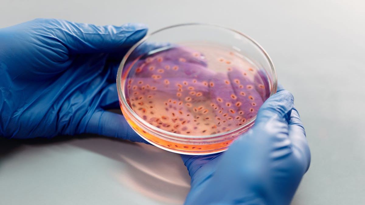 Understanding C. Diff Bacteria Infection: Causes, Symptoms, and Prevention