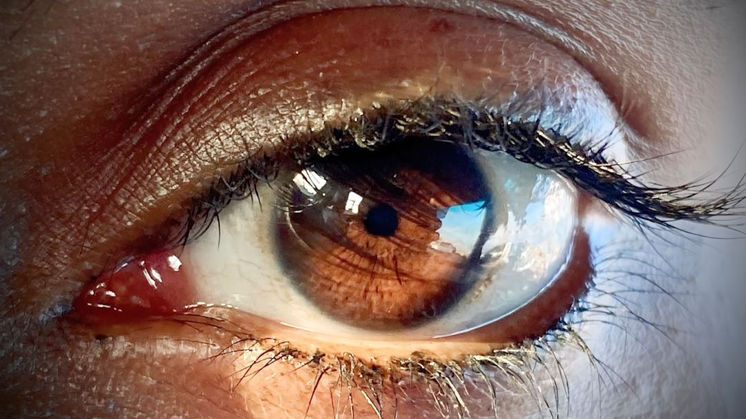 Comprehensive Guide to LASIK Eye Surgery: What You Need to Know Before Your Procedure