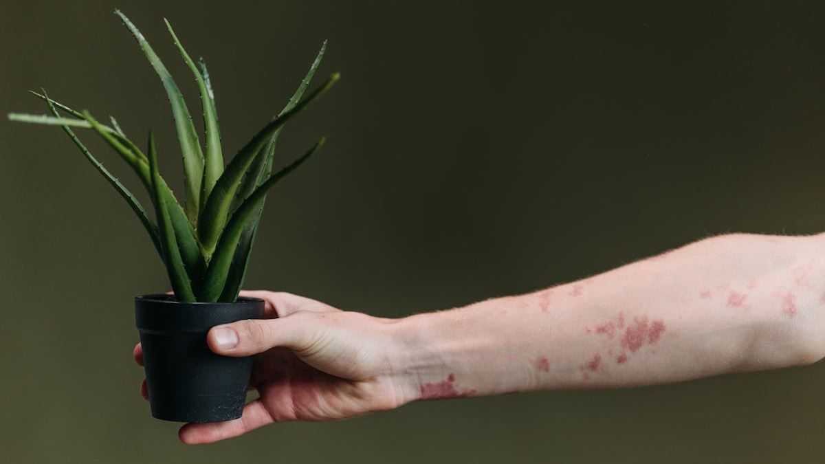 Understanding Rashes That Look Like Eczema: Causes, Symptoms, and Treatment