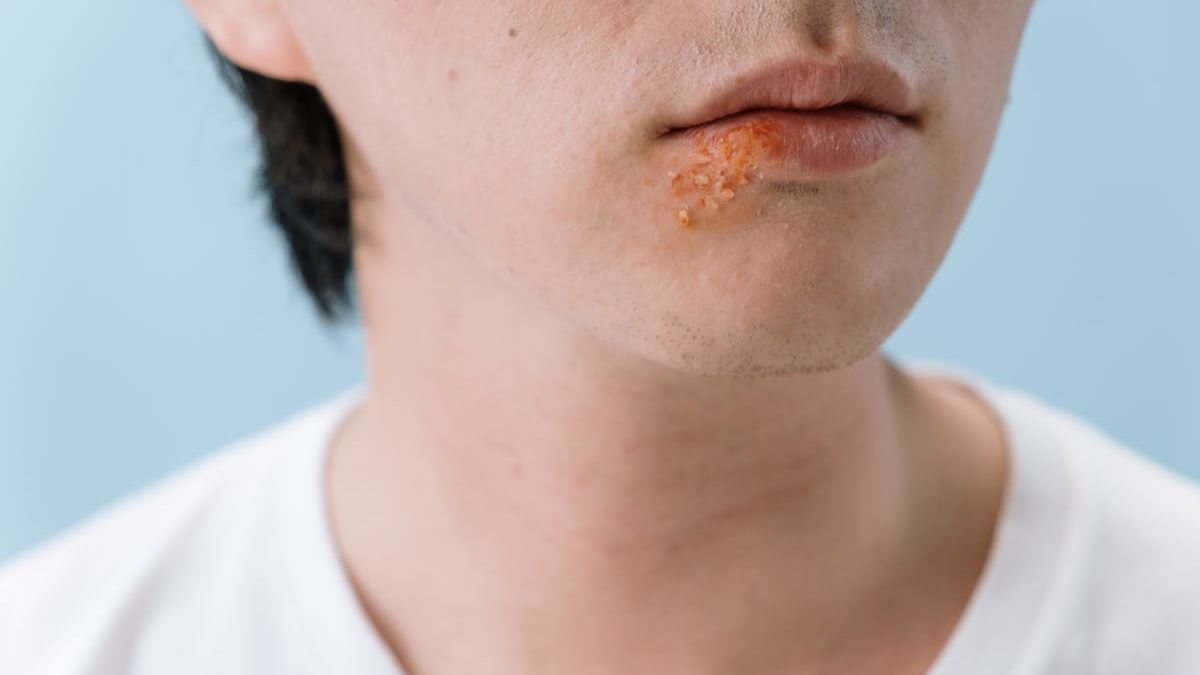 Understanding Skin Infections: Does Skin Infection Look Like What You Expect?